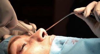 Gençler Güzellik Uğruna Bıçak Altında: Estetikte Yaş Sınırı 18’in Altına Geriledi