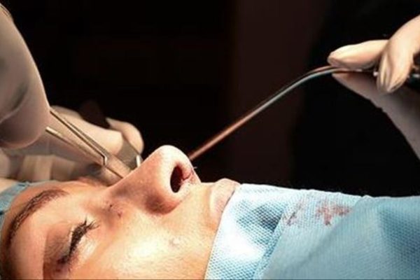Gençler Güzellik Uğruna Bıçak Altında: Estetikte Yaş Sınırı 18’in Altına Geriledi