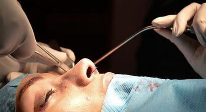 Gençler Güzellik Uğruna Bıçak Altında: Estetikte Yaş Sınırı 18’in Altına Geriledi